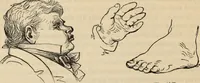 An illustration from New Physiognomy : or signs of character, as manifested through temperament and external forms, and especially in the "the human face divine." (1889)