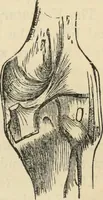 Picture 36 of 697 from New Physiognomy : or signs of character, as manifested through temperament and external forms, and especially in the "the human face divine." (1889), leaf 80