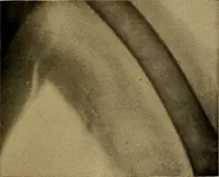Picture 49 of 168 from Notes on X-light (1903), leaf 552