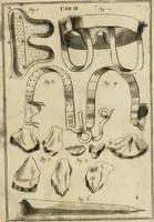 An illustration from Observations chirvrgiqves (1669)