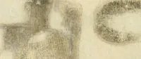 An illustration from Observations chirvrgiqves (1669)