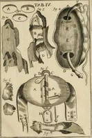 An illustration from Observations chirvrgiqves (1669)