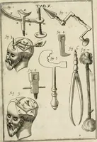 An illustration from Observations chirvrgiqves (1669)
