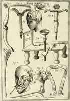 An illustration from Observations chirvrgiqves (1669)