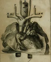 Picture 3 of 13 from Observations sur la maniere de tailler dans les deux sexes pour l'extraction de la pierre, pratiquée par Frere Jacques (1700), leaf 146
