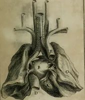 Picture 5 of 13 from Observations sur la maniere de tailler dans les deux sexes pour l'extraction de la pierre, pratiquée par Frere Jacques (1700), leaf 152