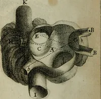 Picture 6 of 13 from Observations sur la maniere de tailler dans les deux sexes pour l'extraction de la pierre, pratiquée par Frere Jacques (1700), leaf 155