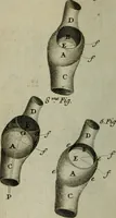 Picture 8 of 13 from Observations sur la maniere de tailler dans les deux sexes pour l'extraction de la pierre, pratiquée par Frere Jacques (1700), leaf 161