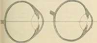 An illustration from Oeuvres ophthalmologiques de Thomas Young (1894)