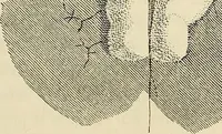 An illustration from Oeuvres ophthalmologiques de Thomas Young (1894)