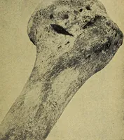 Picture 51 of 160 from Ohio archæological and historical quarterly (1887), leaf 324