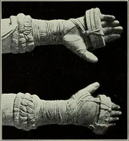 An illustration from Olympic victor monuments and Greek athletic art (1921)