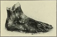 Picture 83 of 110 from Olympic victor monuments and Greek athletic art (1921), leaf 332