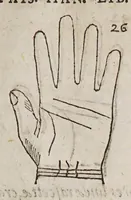 Picture 7 of 46 from Opus mathematicum octo libros complectens, : innumeris propemodum figuris idealibus manuum et physiognomiae, aliisque adornatum, quorum sex priores libri absolutissimae cheiromantiae theoricam, praxim, doctrinam, artem, & experientiam verissimam continent. Septimus physiognomiae dispositionem, hominʹumque omnium qualitates & complexiones. Octauus periaxiomata de faciebus signorum, & quid sol in vnaquaque domo existens, natis polliceatur. Remedia quoque omnium ægritudinum complectitur. Et naturalem astrologiam atq[ue] effectus lunae quoad diuersas ægritudines. Item isagogen astrologiæ iudiciariae, & totius diuinatricis artis encomia. Omnibus matheseos, cheiromantiae, philosophiae, & medicinæ studiosis vtiles ac necessarij. (1583), leaf 125