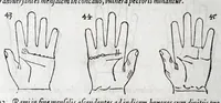 Picture 5 of 38 from Opvs mathematicvm octo libros complectens : innvmeris propemodvm figvris idealibvs manvvm et physiognomiae, aliisqve adornatvm, qvorvm sex priores libri absolutissimae cheiromantiae theoricam, praxim, doctrinam, artem, & experientiam verissimam continent : septimus physiognomiae dispositionem, hominumque omnium qualitates & complexiones : octauus periaxiomata de faciebus signorum, & quid sol in vnaquaque domo existens, natis polliceatur : remedia quoq; omnium aegritudinum complectitur : et naturalem astrologiam atq; effectus lunae quoad diuersas aegritudines : item isagogen astrologiae iudiciariae, & totius diuinatricis artis encomia ... (1562), leaf 112