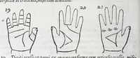 An illustration from Opvs mathematicvm octo libros complectens : innvmeris propemodvm figvris idealibvs manvvm et physiognomiae, aliisqve adornatvm, qvorvm sex priores libri absolutissimae cheiromantiae theoricam, praxim, doctrinam, artem, & experientiam verissimam continent : septimus physiognomiae dispositionem, hominumque omnium qualitates & complexiones : octauus periaxiomata de faciebus signorum, & quid sol in vnaquaque domo existens, natis polliceatur : remedia quoq; omnium aegritudinum complectitur : et naturalem astrologiam atq; effectus lunae quoad diuersas aegritudines : item isagogen astrologiae iudiciariae, & totius diuinatricis artis encomia ... (1562)