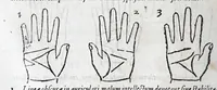 An illustration from Opvs mathematicvm octo libros complectens : innvmeris propemodvm figvris idealibvs manvvm et physiognomiae, aliisqve adornatvm, qvorvm sex priores libri absolutissimae cheiromantiae theoricam, praxim, doctrinam, artem, & experientiam verissimam continent : septimus physiognomiae dispositionem, hominumque omnium qualitates & complexiones : octauus periaxiomata de faciebus signorum, & quid sol in vnaquaque domo existens, natis polliceatur : remedia quoq; omnium aegritudinum complectitur : et naturalem astrologiam atq; effectus lunae quoad diuersas aegritudines : item isagogen astrologiae iudiciariae, & totius diuinatricis artis encomia ... (1562)