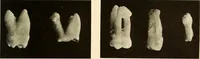An illustration from Oral Roentgenology : a Roentgen study of the anatomy and pathology of the oral cavity (1917)