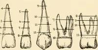An illustration from Oral Roentgenology : a Roentgen study of the anatomy and pathology of the oral cavity (1917)