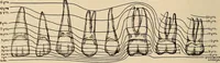 An illustration from Oral Roentgenology : a Roentgen study of the anatomy and pathology of the oral cavity (1917)