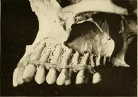 An illustration from Oral Roentgenology : a Roentgen study of the anatomy and pathology of the oral cavity (1917)