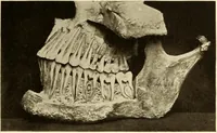 An illustration from Oral Roentgenology : a Roentgen study of the anatomy and pathology of the oral cavity (1917)