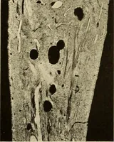 An illustration from Oral Roentgenology : a Roentgen study of the anatomy and pathology of the oral cavity (1917)
