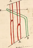 An illustration from Ourdissage (1700)