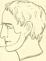 An illustration from Outlines of lectures on the neurological system of anthropology, as discovered, demonstrated and taught in 1841 and 1842 (1854)