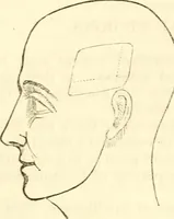 An illustration from Outlines of lectures on the neurological system of anthropology, as discovered, demonstrated and taught in 1841 and 1842 (1854)