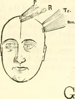 Picture 36 of 43 from Outlines of lectures on the neurological system of anthropology, as discovered, demonstrated and taught in 1841 and 1842 (1854), leaf 335