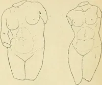 An illustration from Répertoire de la statuaire grecque et romaine (1908)
