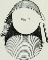 An illustration from Pedlar fireproofing products : catalogue no. 19R. -- (1911)