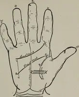 An illustration from Perin's science of palmistry; a complete and authentic treatise (1902)