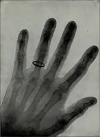 An illustration from Perin's science of palmistry; a complete and authentic treatise (1902)