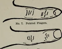 An illustration from Perin's science of palmistry; a complete and authentic treatise (1902)