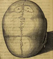 Picture 19 of 63 from Petri Paaw Amsteldamensis, in Academia Lugduno-Batava anatomici & botanici professoris Primitiae anatomicae : de humani corporis ossibus (1615), leaf 69