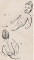 An illustration from Philosophical transactions of the Royal Society of London (1665)