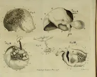 Picture 2 of 9 from Philosophical transactions of the Royal Society of London (1699), leaf 86