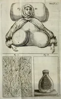 Picture 2 of 3 from Philosophical transactions of the Royal Society of London (1670), leaf 162
