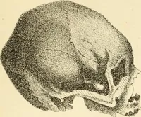 An illustration from Phrenology in connection with the study of physiognomy : to which is prefixed a biography of the author by Nahum Capen (1836)