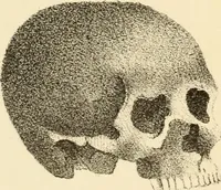 Picture 35 of 79 from Phrenology in connection with the study of physiognomy : to which is prefixed a biography of the author by Nahum Capen (1836), leaf 398