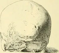 An illustration from Phrenological development of Robert Burns, from a cast of his skull moulded at Dumfries, the 31st day of March, 1834 (1859)