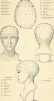An illustration from Phrenological development of Robert Burns, from a cast of his skull moulded at Dumfries, the 31st day of March, 1834 (1859)