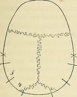 Picture 5 of 80 from Phrenologische Bilder : zur Naturlehre des menschlichen Geistes und deren Anwendung Wissenschaft und Leben (1855), leaf 194