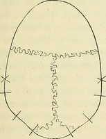 Picture 6 of 80 from Phrenologische Bilder : zur Naturlehre des menschlichen Geistes und deren Anwendung Wissenschaft und Leben (1855), leaf 194