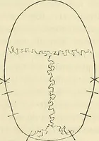 Picture 8 of 80 from Phrenologische Bilder : zur Naturlehre des menschlichen Geistes und deren Anwendung Wissenschaft und Leben (1855), leaf 194