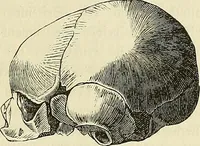 Picture 13 of 80 from Phrenologische Bilder : zur Naturlehre des menschlichen Geistes und deren Anwendung Wissenschaft und Leben (1855), leaf 336