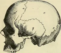 An illustration from Phrenologische Bilder : zur Naturlehre des menschlichen Geistes und deren Anwendung Wissenschaft und Leben (1855)