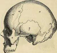 Picture 18 of 80 from Phrenologische Bilder : zur Naturlehre des menschlichen Geistes und deren Anwendung Wissenschaft und Leben (1855), leaf 341